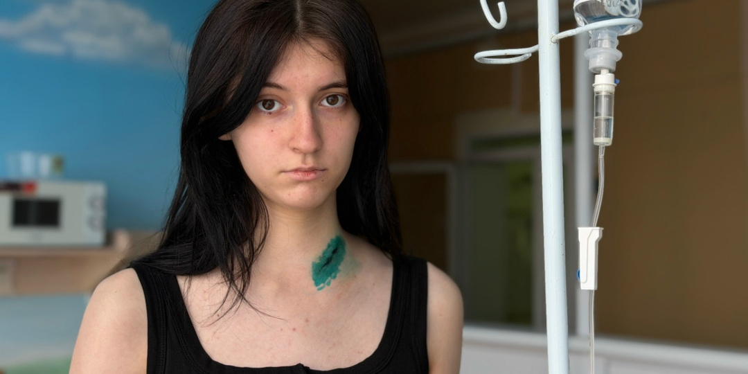 «Я просто хочу выжить». 16-летняя Маша из Донецка борется с агрессивным раком