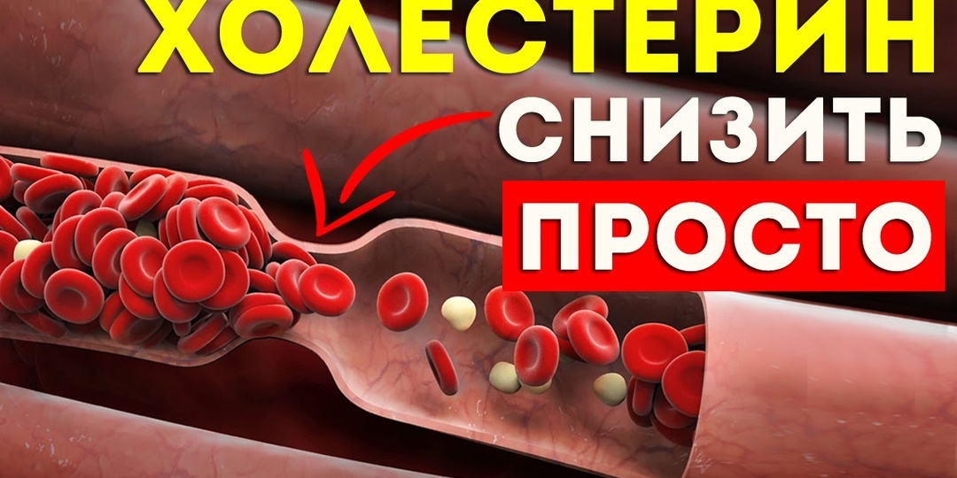Что нужно перестать есть, чтобы снизить уровень холестерина, а что стоит включить в свой рацион
