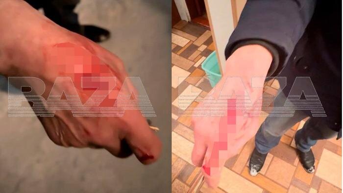 В Подмосковье пенсионер остался без жилья за 7 млн после ножевого ранения. Фото © Telegram / Baza