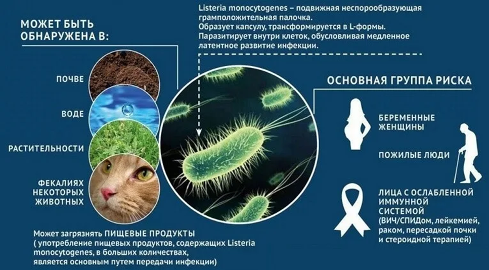Листериоз