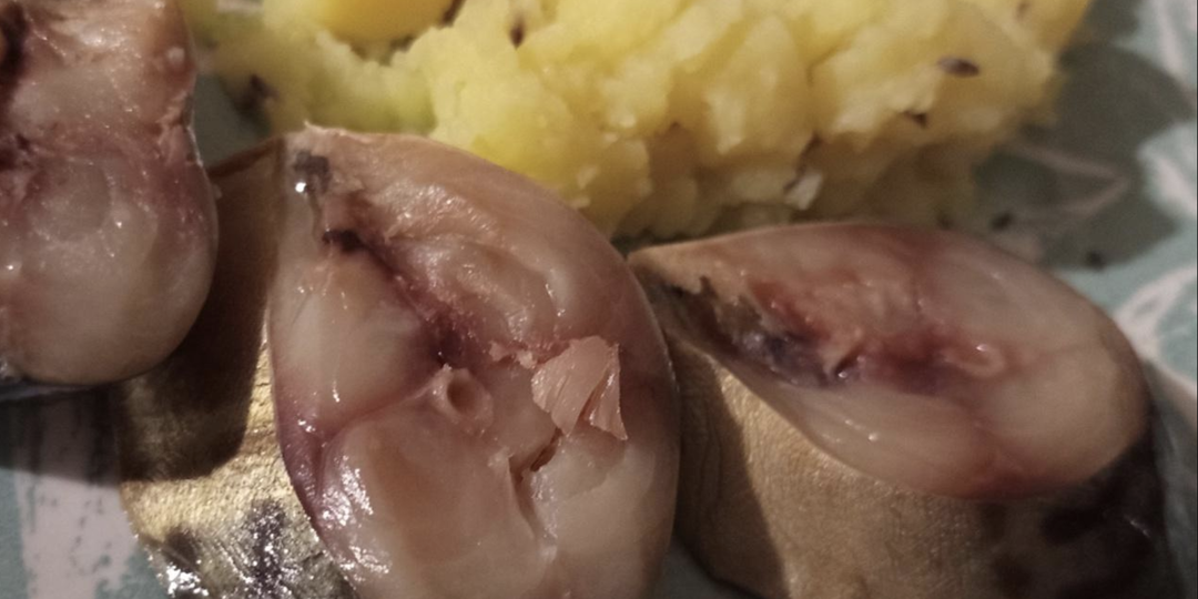 Жировой гепатоз: можно ли вылечить печень? 3 продукта