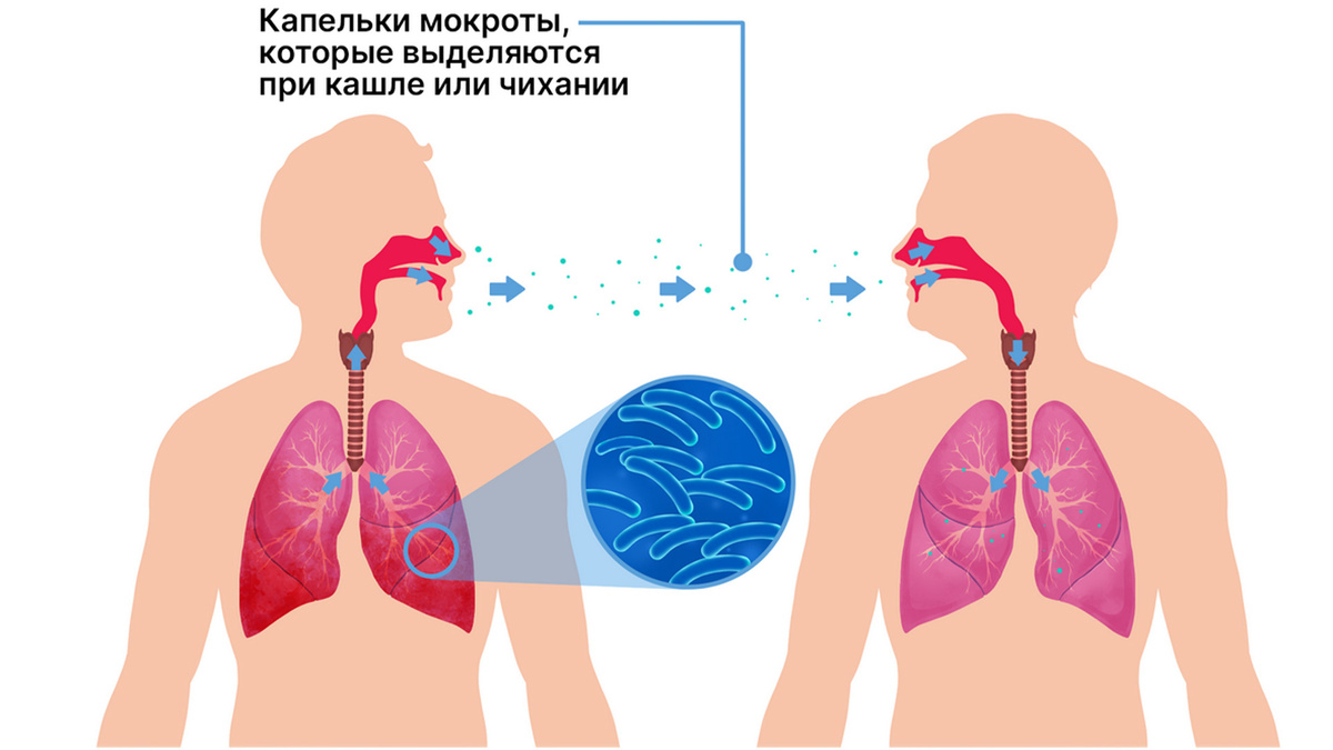 как передаётся туберкулёз