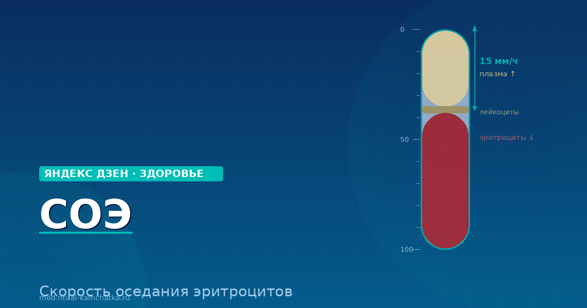 Повышенный СО