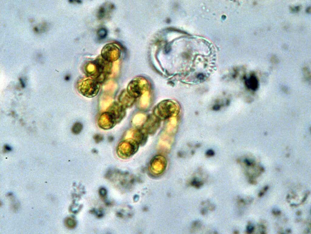    Цианобактерии Anabaena spiroides / © Environmental Protection Agency, epa.gov