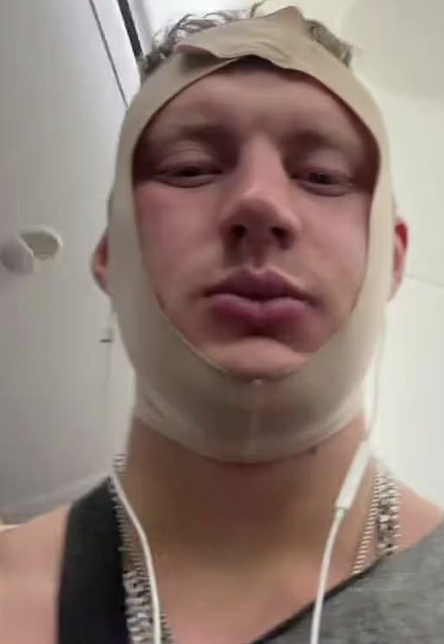 -2
