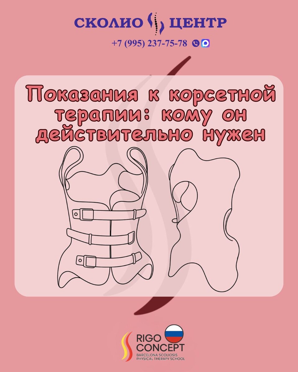 Показания к корсетной терапии: кому он действительно нужен
