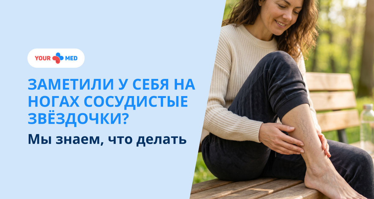 Почему появляются сосудистые звездочки на ногах и как от них избавиться. Современные методы лечения — склеротерапия и лазерная коагуляция, а также рекомендации по профилактике.
