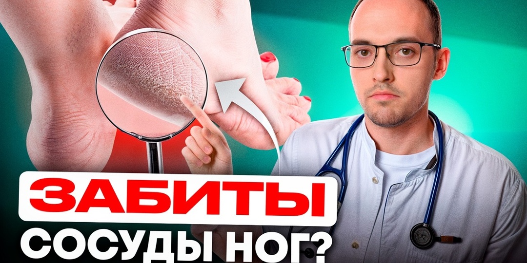 5 признаков забитых холестерином сосудов ног - как распознать угрозу