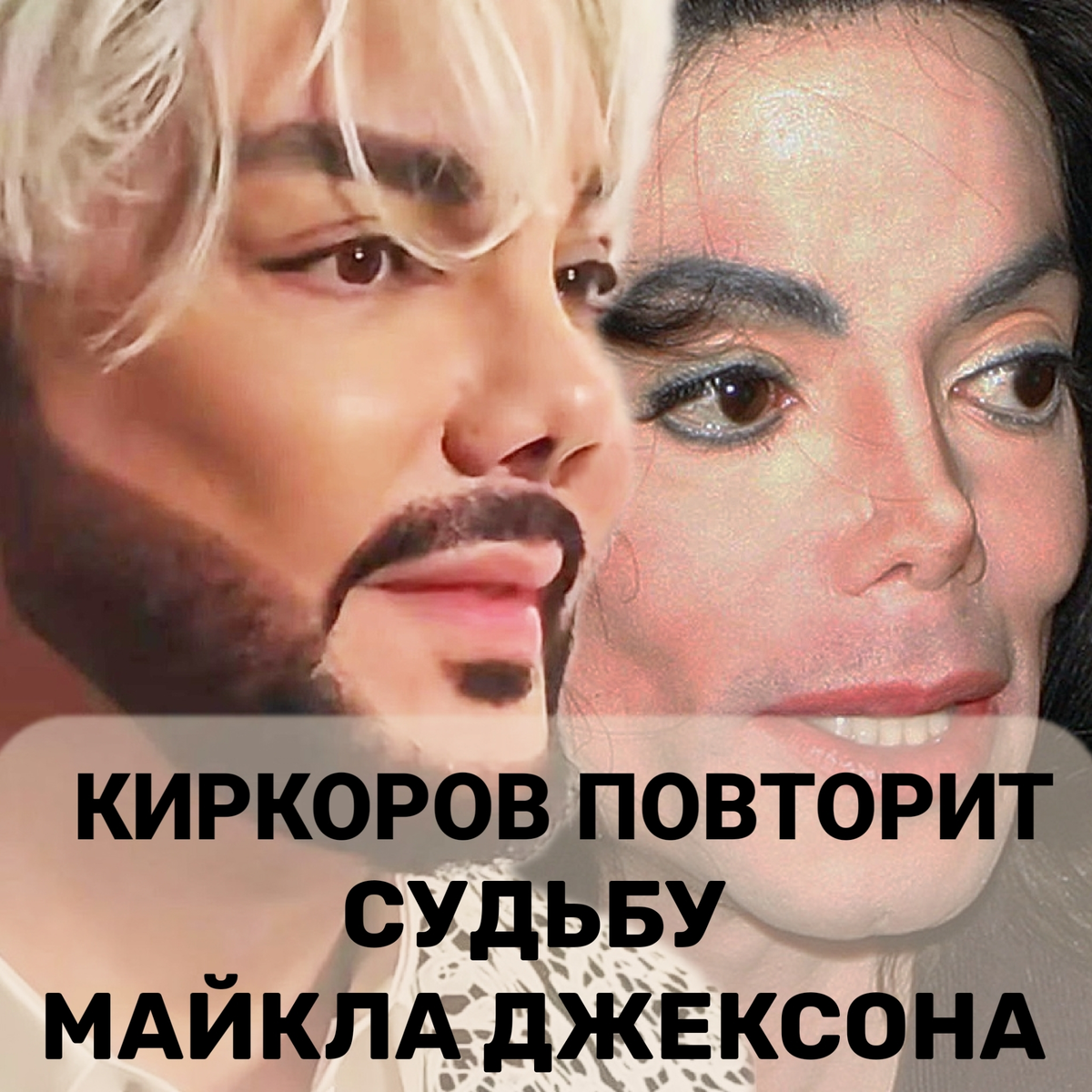 Филипп Киркоров - российский Майкл Джексон - повторяет его судьбу.