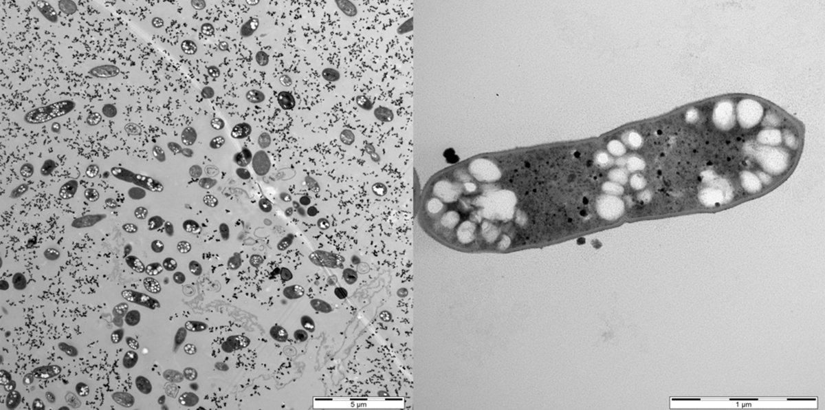    Электронная микрофотография анаэробной бактерии рода Acetobacterium