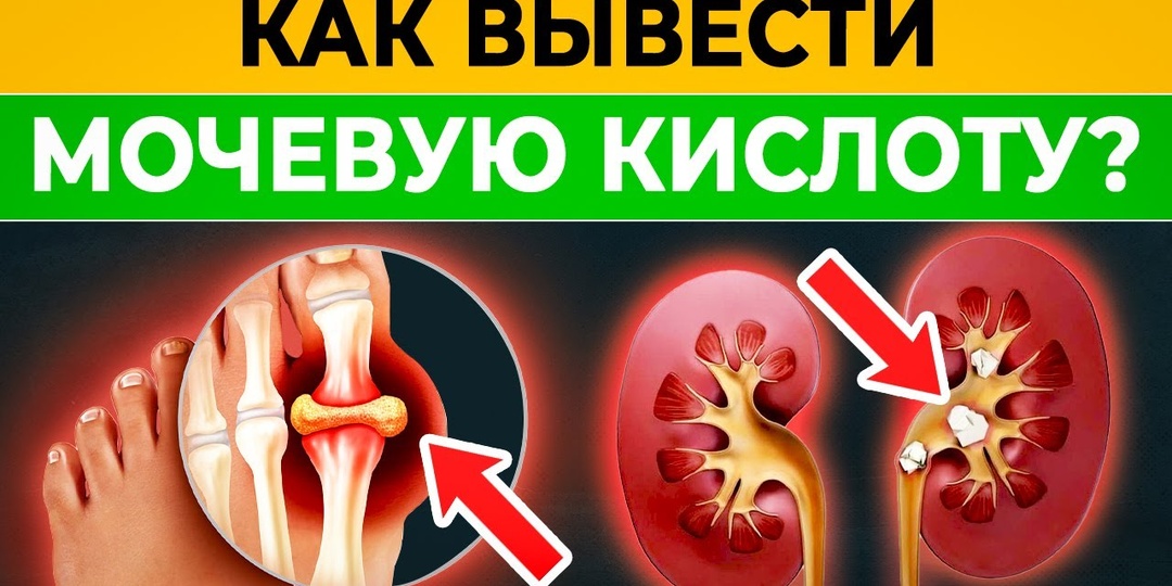 Вернула здоровье суставам и понизила мочевую кислоту. 7 привычек в рационе, возвращающие подвижность в 60 лет