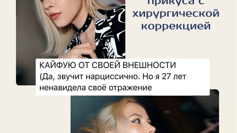 Когда брекетов недостаточно