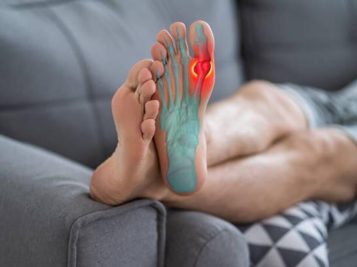    подагра | © iStock.com
