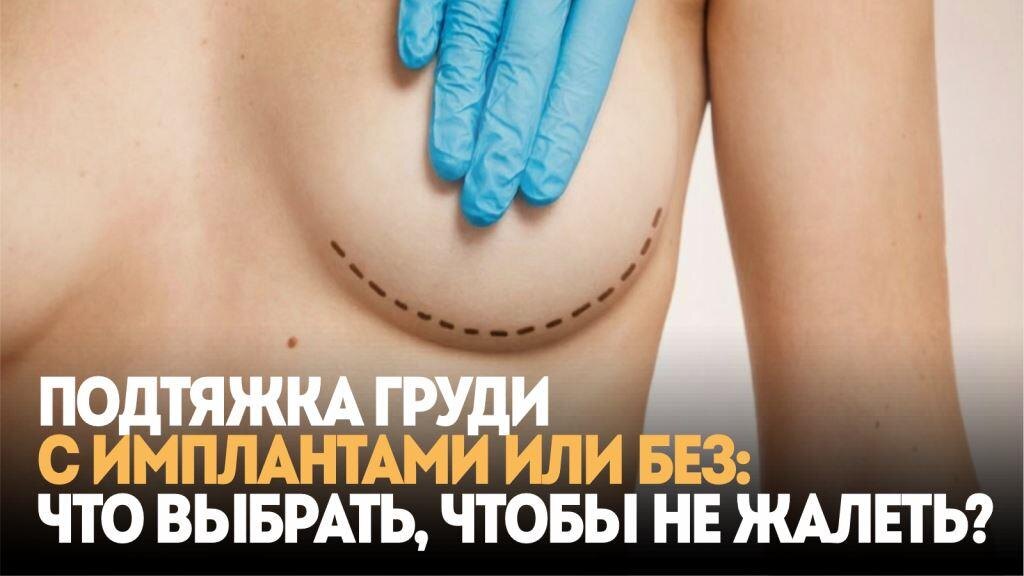 Подтяжка груди с имплантами или без что выбрать, чтобы не жалеть