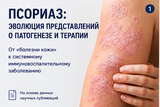 Псориаз