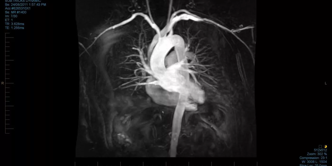 Ваше сердце стареет. Но не так, как вы думаете