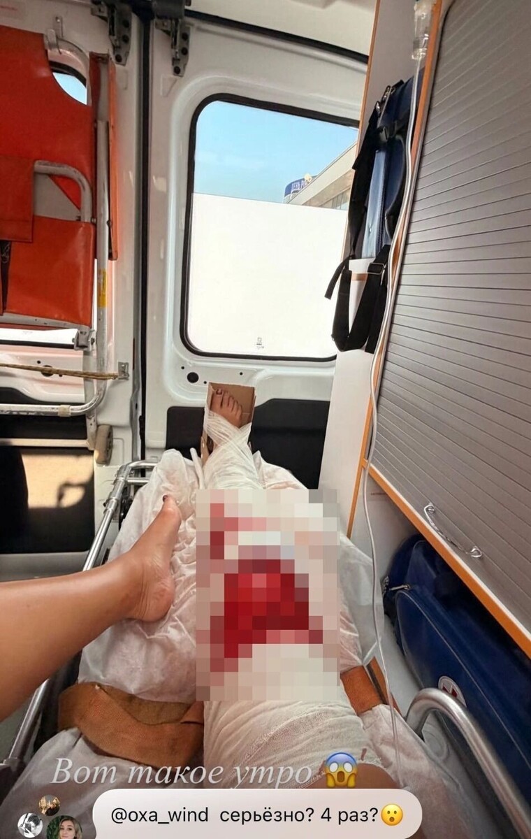    Ольга Бузова попала в больницу с травмой ноги   соцсети Ольги Бузовой