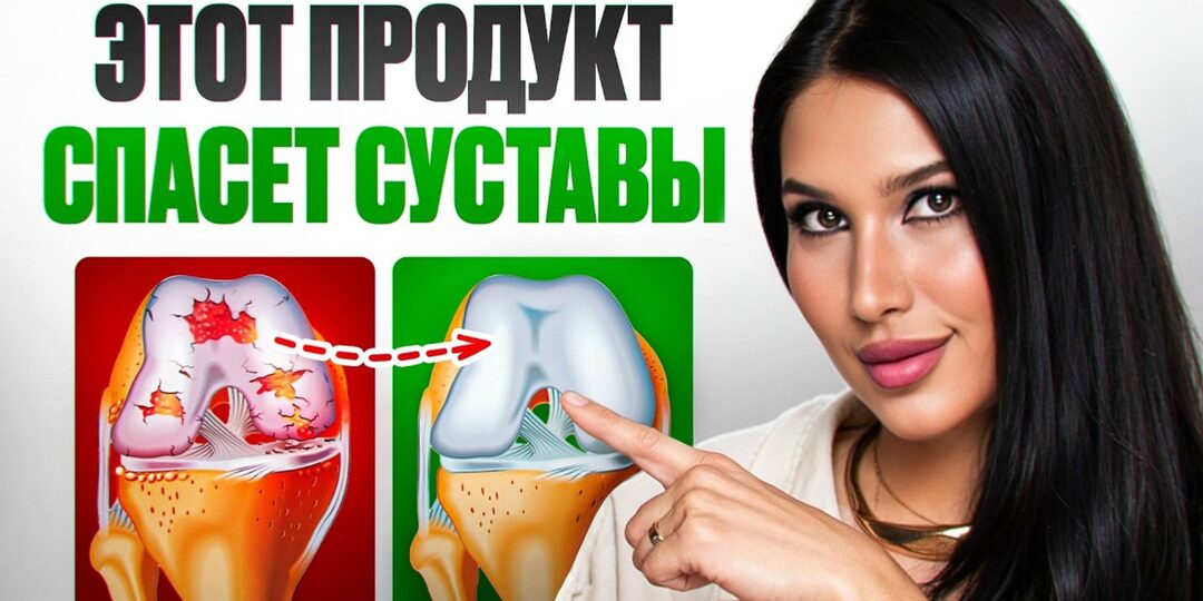 Вывела лишнюю мочевую кислоту и спасла свои суставы. 9 правильных продуктов для восстановления коленей