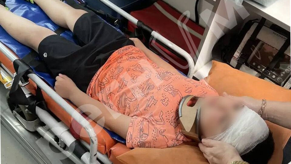В Балашихе самокатчик сбил ребенка на детской площадке и уехал