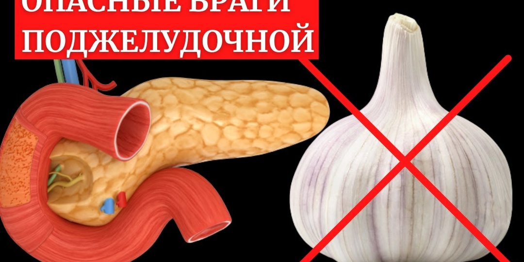 Два самых опасных продукта для поджелудочной железы летом, которые вызывают обострение хронического панкреатита