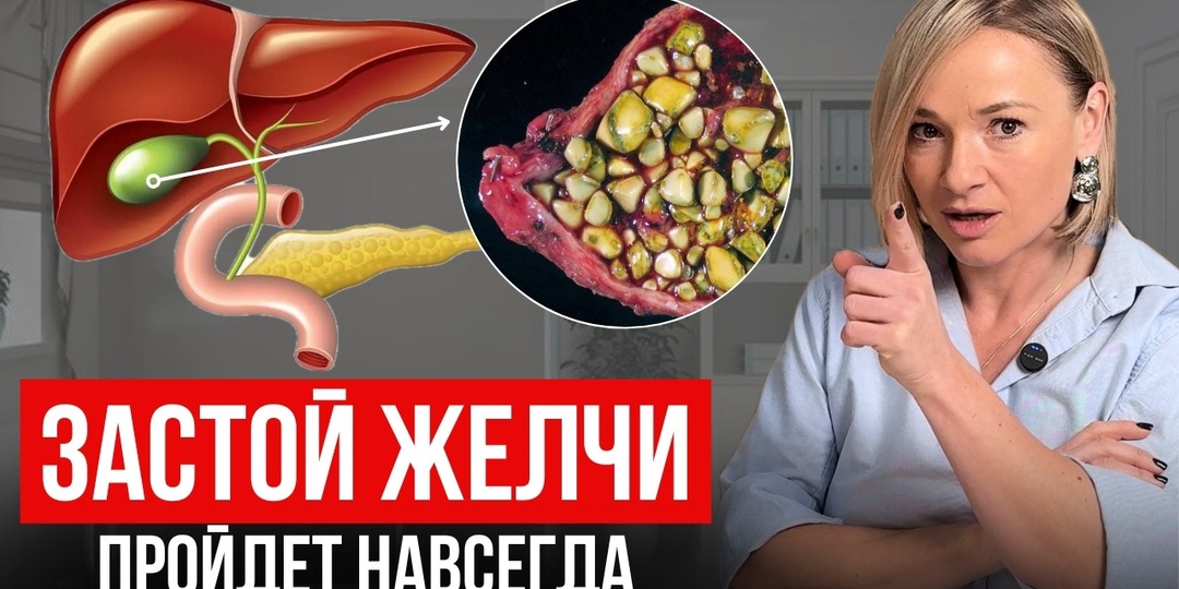 Повторяла за китайцами и избавилась от проблем с желчным пузырем - 4 симптома “густой желчи” и 7 продуктов для ее оттока