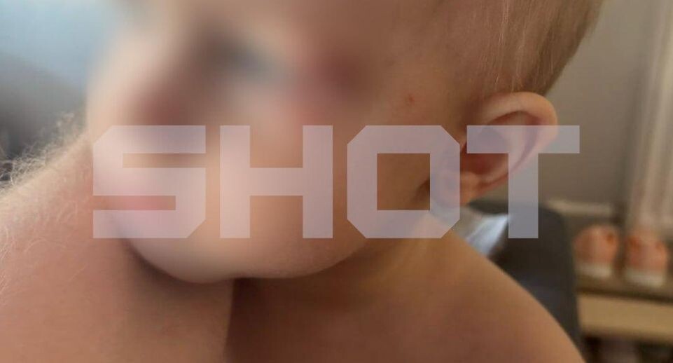    Telegram-канал SHOT