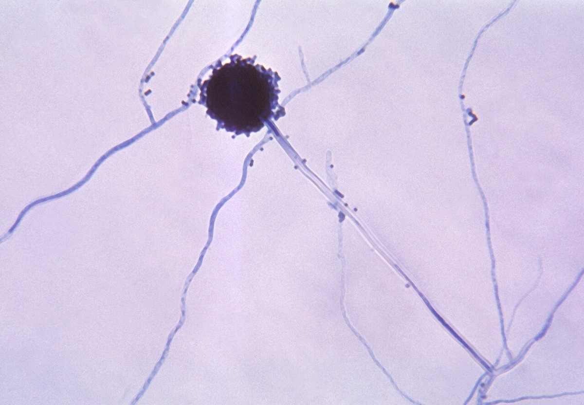    Конидий черной плесени (гриба Aspergillus niger)