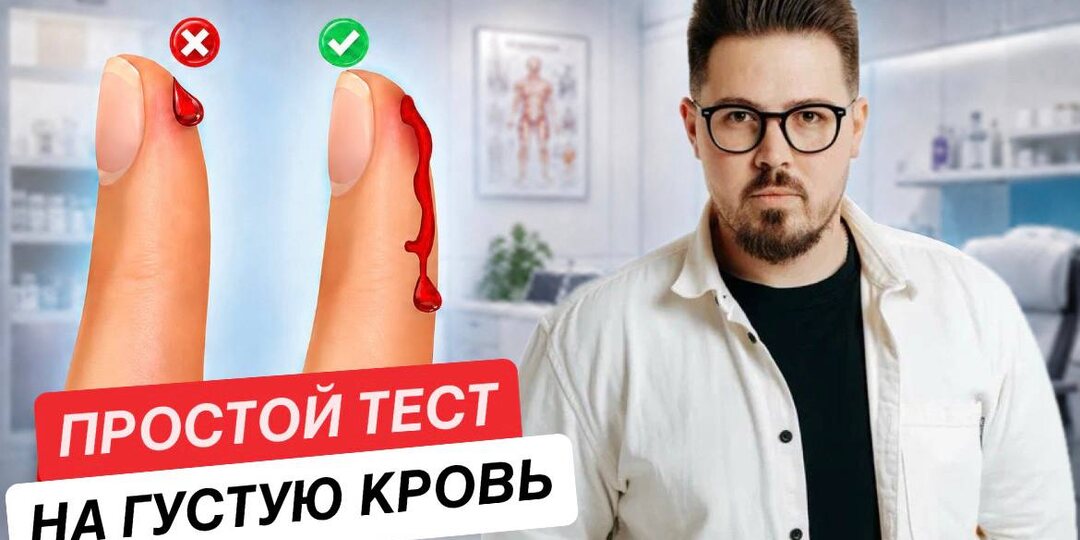 3 домашних теста на густоту крови и 7 признаков, которые многие игнорируют