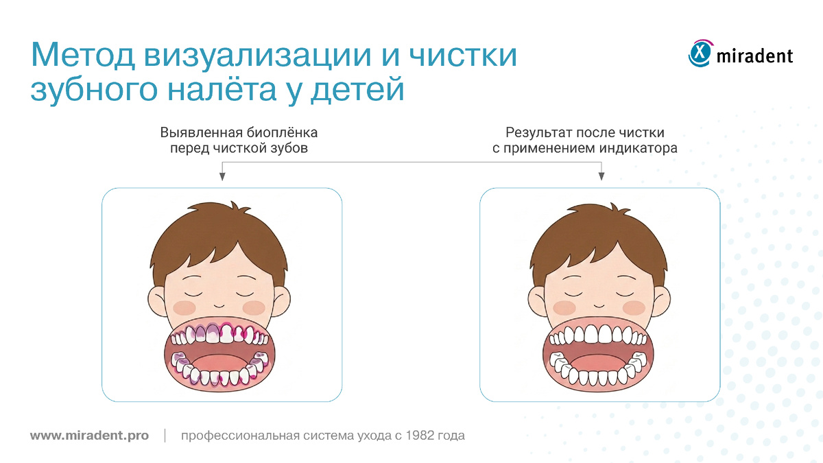 Индикатор налёта трансформирует чистку из ритуала в навык: ребёнок видит конкретные зоны, требующие работы, и учится оценивать результат объективно.