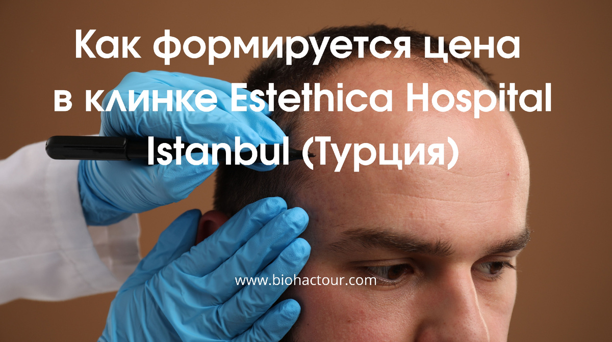 Разметка зоны роста волос перед операцией в Estethica Hospital Istanbul — определение линии импланта по фиксированной цене Sapphire FUE €1 490 и DHI €1 640