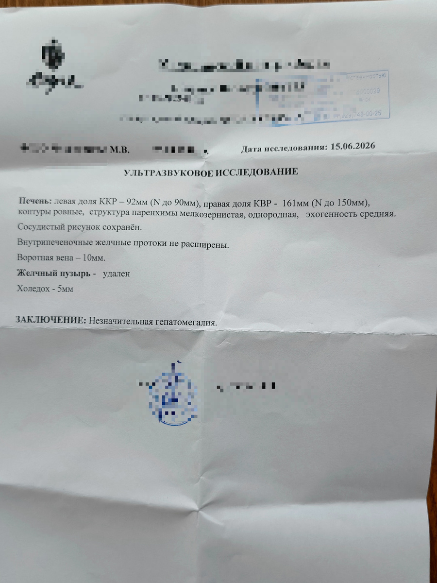Свежее УЗИ подтвердило: печень увеличена, но незначительно. Болит не она. А что именно — разбираемся дальше