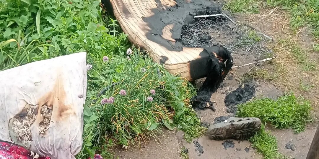 В Башкирии при пожаре мужчина получил страшные ожоги