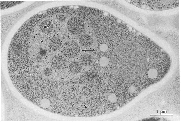 Источник: Nature Reviews Molecular Cell Biology. Как клетка перерабатывает свой мусор во время поста