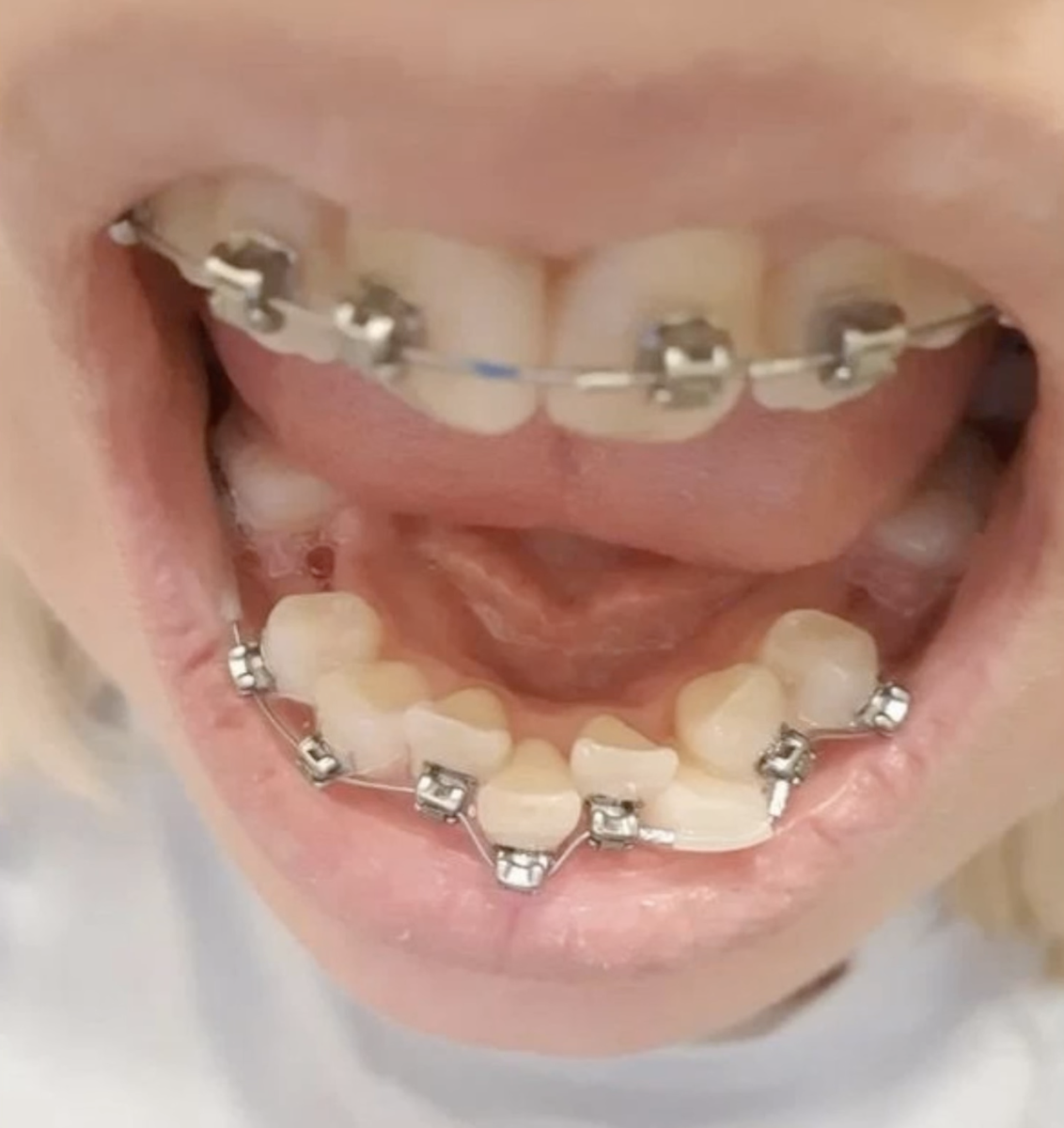 -2