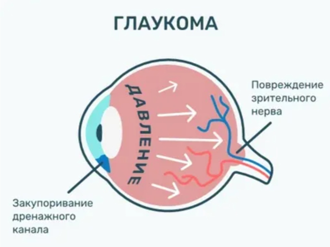 Изображение из сервиса Яндекс картинки 