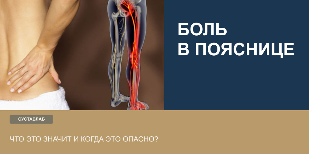 Боль в пояснице отдаёт в ногу: что это значит и когда опасно