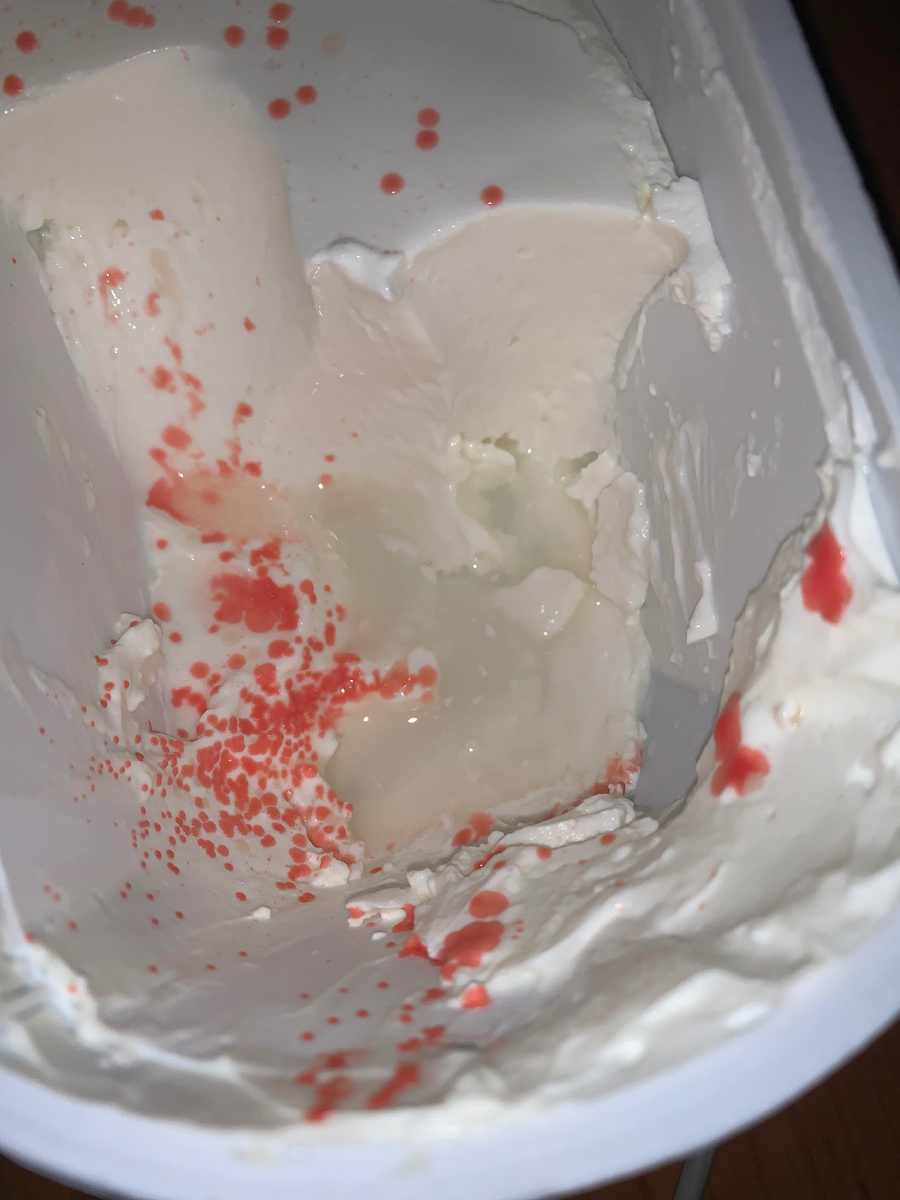 Serratia marcescens