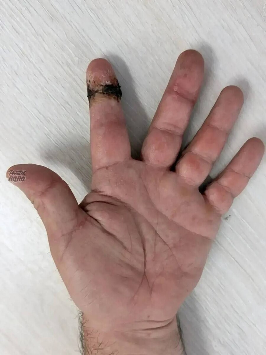 -2