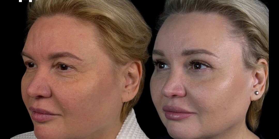 «Все на работе обалдели», - сказала пациентка. А я всего лишь сделал ей эту небольшую операцию!
