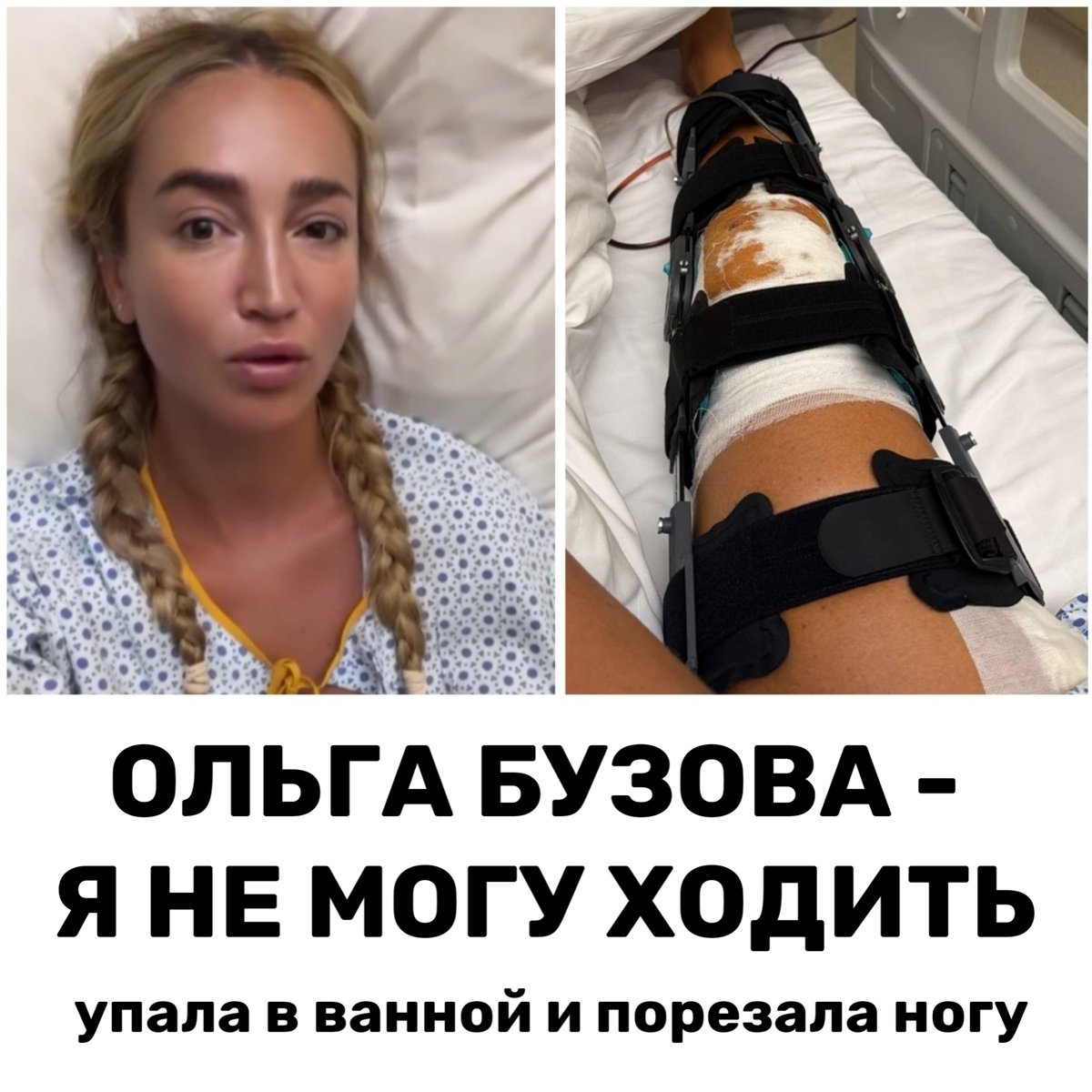 Серьезный порез ноги