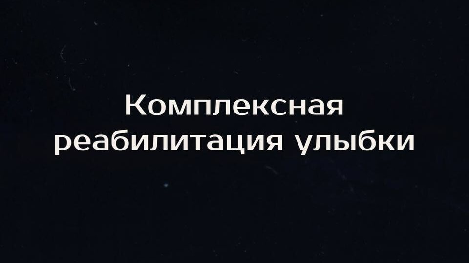 Путь к этому результату занял около 1,5 лет и включал в себя ортодонтическое лечение на брекет-системе
