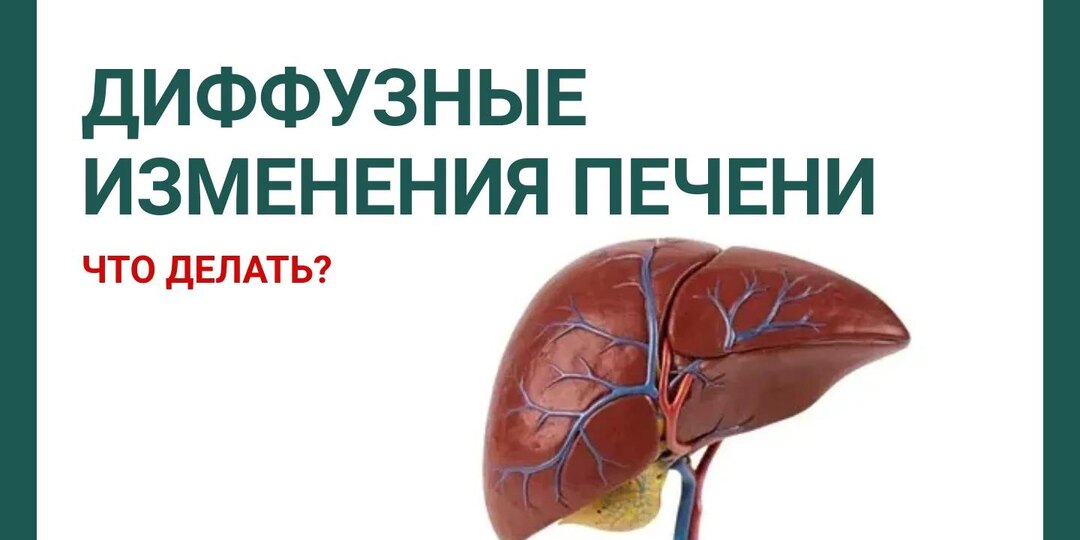 «Диффузные изменения печени» на УЗИ. Что это значит и что с этим делать?