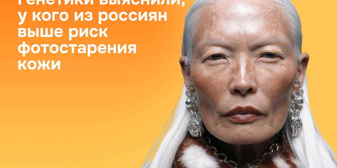 Генетики выяснили, у кого из россиян выше риск фотостарения кожи
