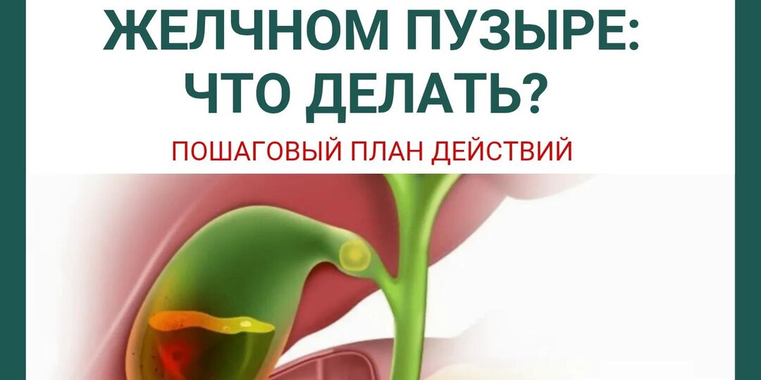 Нашли камни в жёлчном пузыре: что делать? Пошаговый план действий
