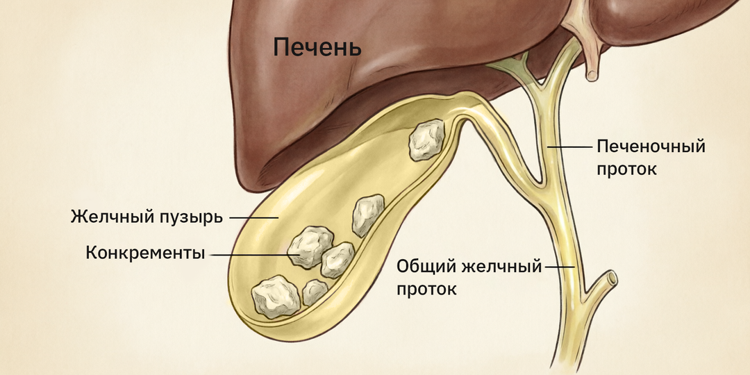 Проблемы с ЖЕЛЧЬЮ: дискинезии, холецистит, желчнокаменная болезнь (ЖКБ)