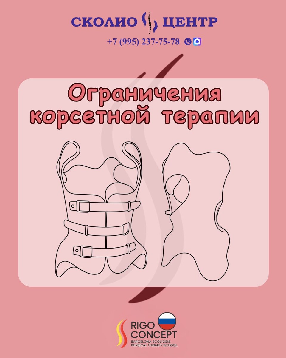 Ограничения корсетной терапии