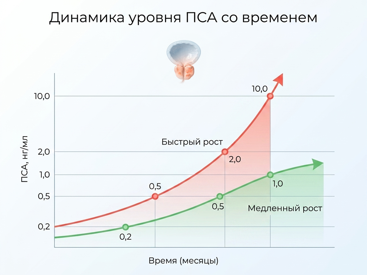 При рецидиве важна не столько сама цифра ПСА, сколько скорость еe роста
