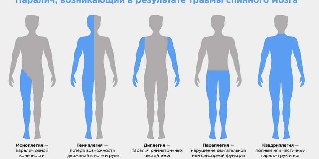 Дыхательная реабилитация при травме спинного мозга на шейном и грудном уровне