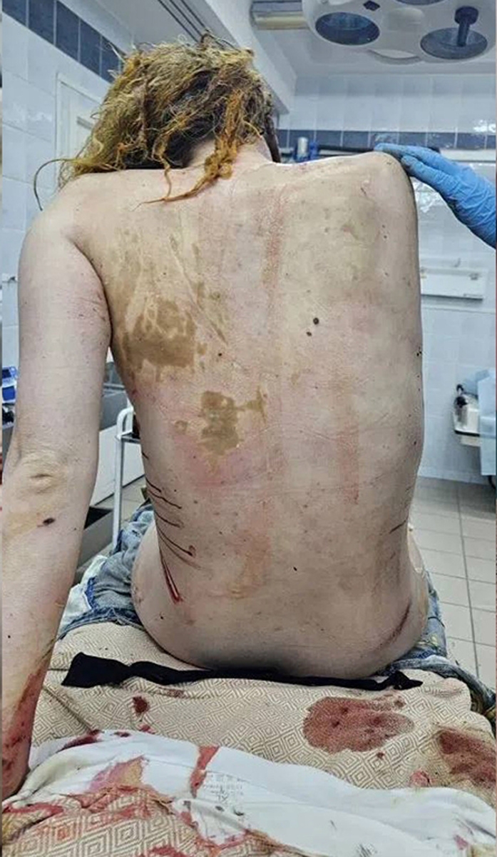    Анастасия Прокофьева попала в больницу в тяжелом состоянииСоцсети