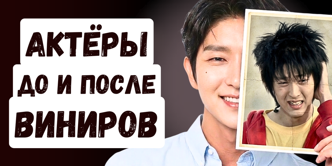 Удивительные преображения корейских актёров, но какую цену они заплатили за красивую улыбку?
